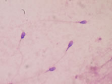 Semen analysis